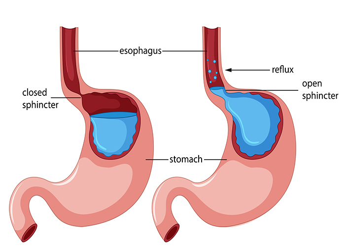 laparoscopic
