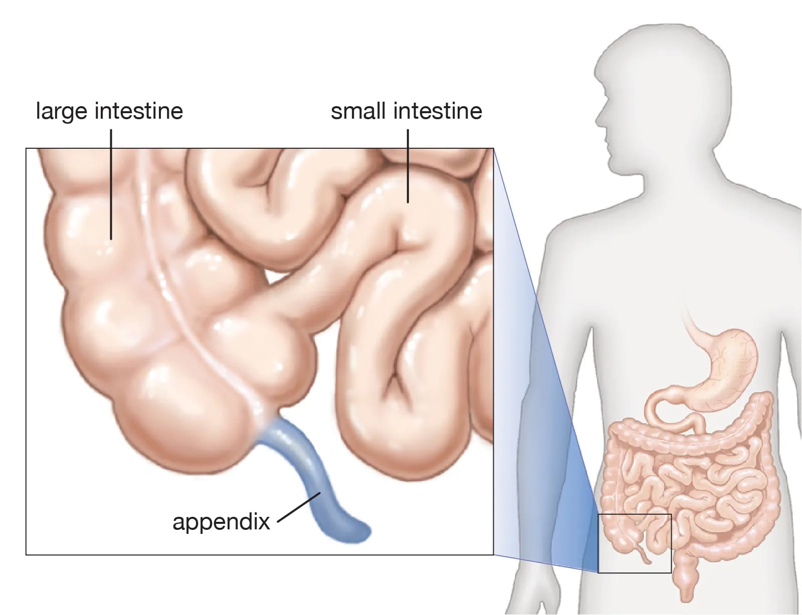 laparoscopic