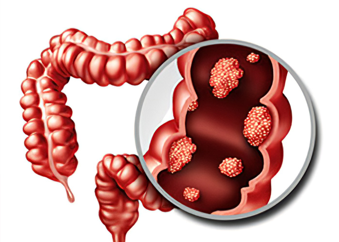 laparoscopic