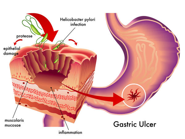 laparoscopic