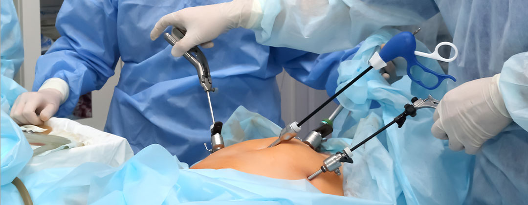 laparoscopic